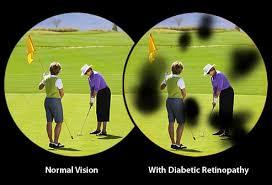 Normal vision compared with vision with diabetic retinopathy