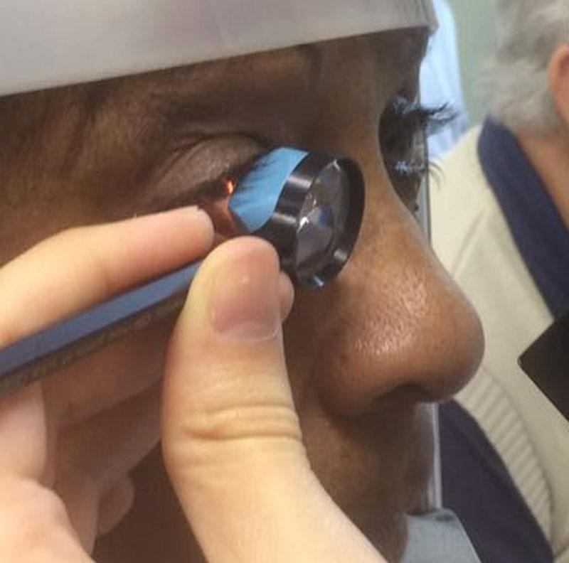How gonioscopy is done