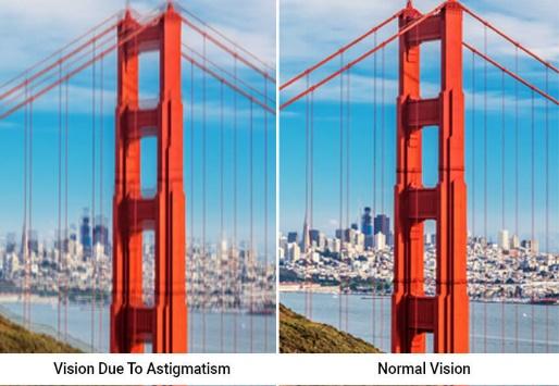A bridge seen with astigmatism and with normal vision
