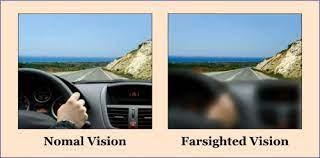 A road seen with normal vision and with far-sighted vision